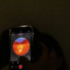 Fundus2