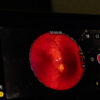Fundus 2