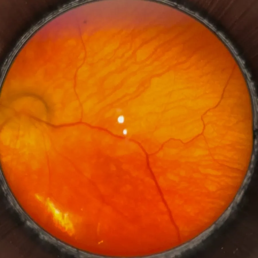 Fundus · EyeMag